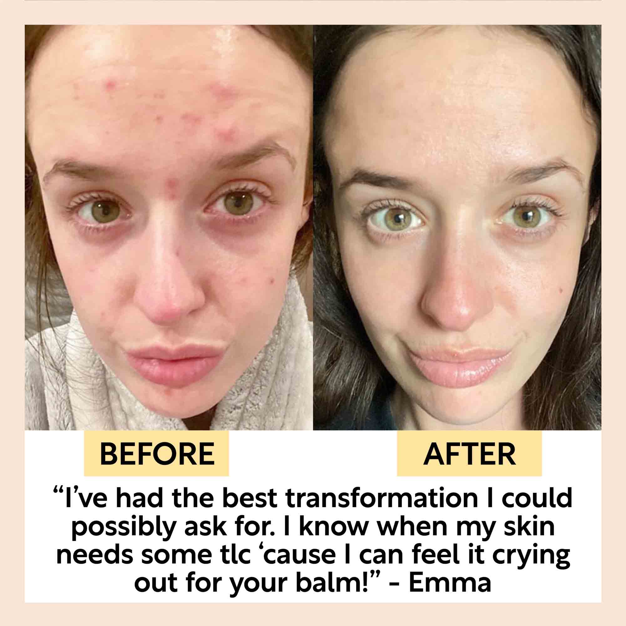 Cleansing Face Balm with Oat Oil + Vitamin E - Image 10