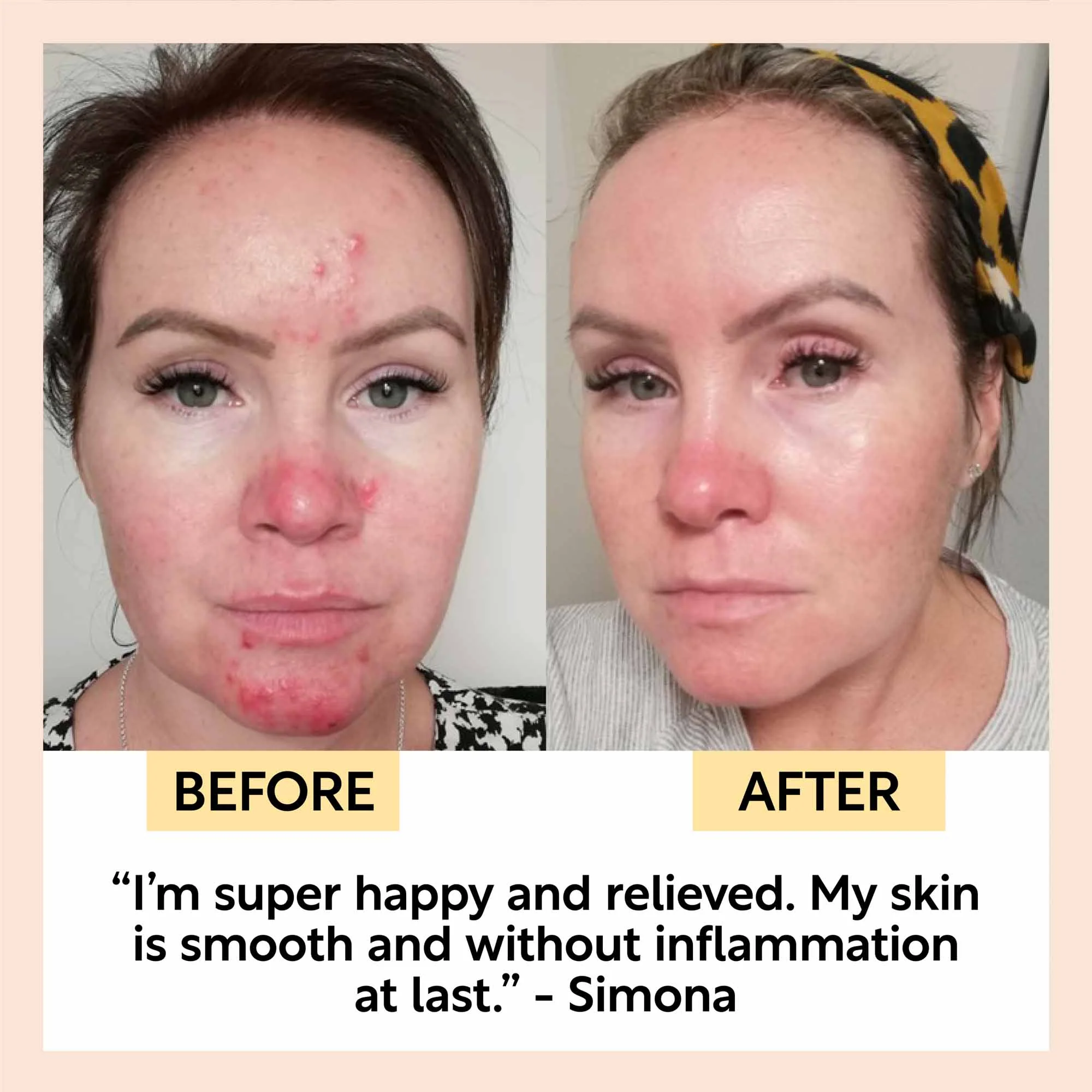 Day + Night Hydration Set - Image 10